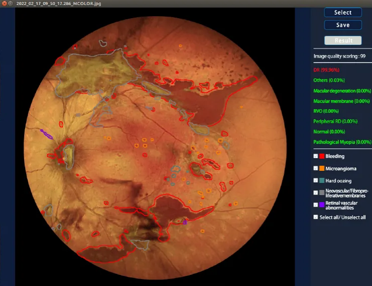 Retinal Imaging Manufacturer