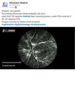 Diabetic retinography pictured by Microclear Apollp, under FFA mode by 240,60 degrees FOV