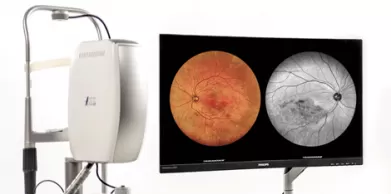 Why Is Retinal Imaging Necessary?