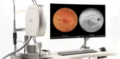 What Is a Digital Retinal Image?